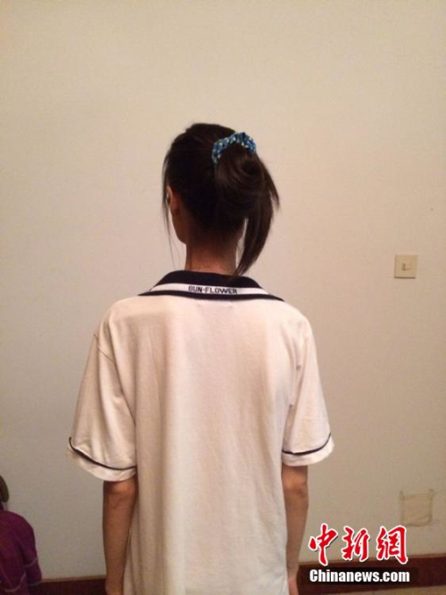 女孩過度節(jié)食導(dǎo)致閉經(jīng)