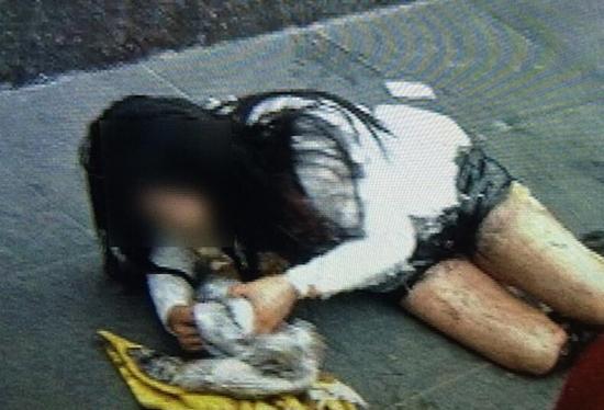 西安一女子當(dāng)街被潑硫酸