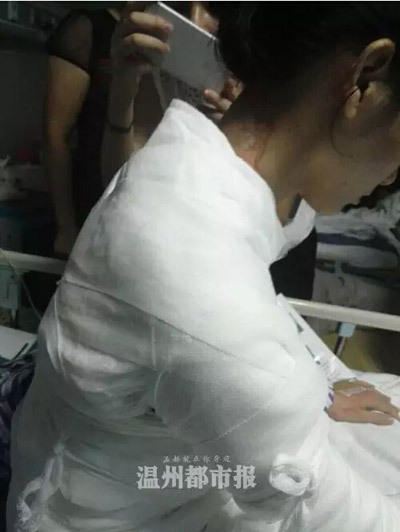 女子遭服務(wù)員潑熱湯