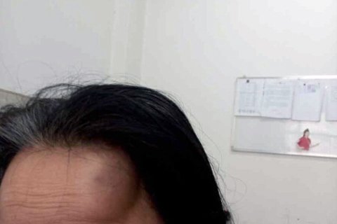 業主被跟蹤毆打