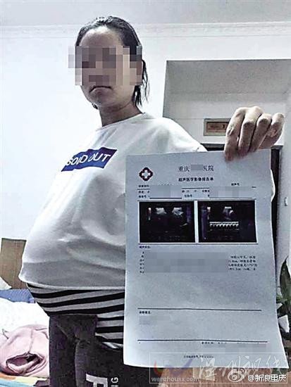 讓懷孕8月妻子引產的丈夫