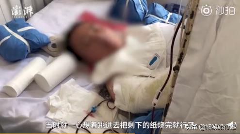 女子燒香掉香灰池導(dǎo)致燒傷